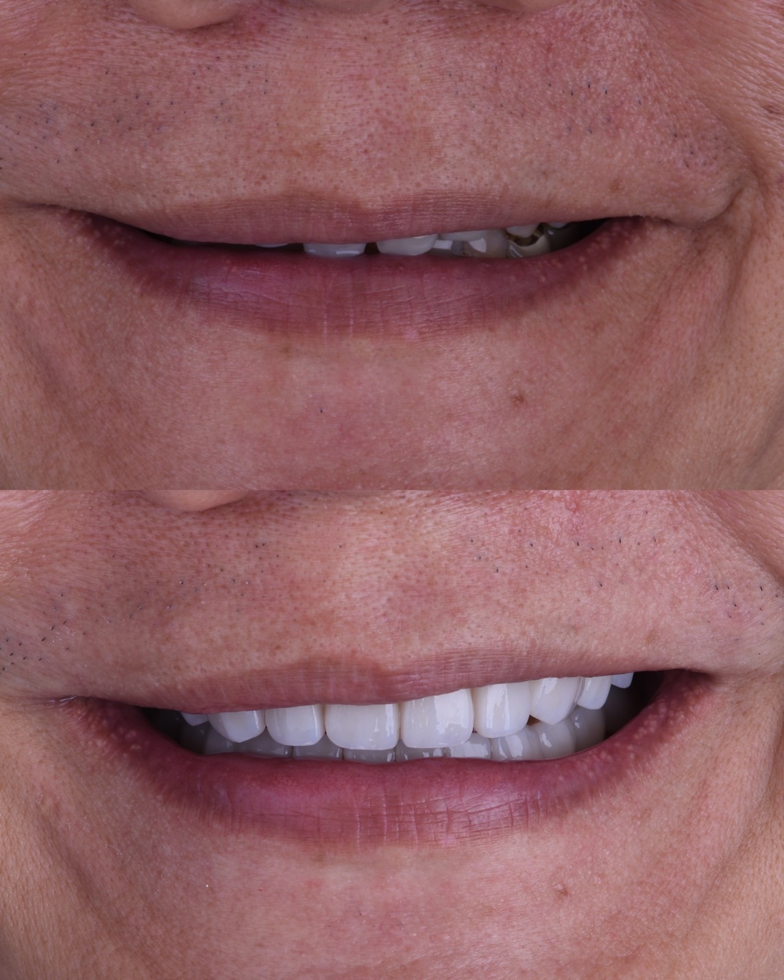 Before and After Case 5